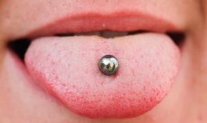 dentista TonguePiercing