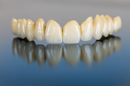 Beautiful ceramic teeth made in the dentist 's office on mirror surface.